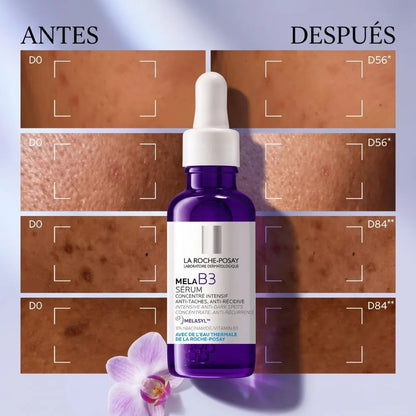 El Sérum que reduce las Manchas de tu Cara por Acné, el Sol y la Edad en las Primeras 8 Semanas