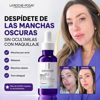 El Sérum que reduce las Manchas de tu Cara por Acné, el Sol y la Edad en las Primeras 8 Semanas